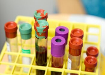 Dark urine could indicate a liver problem