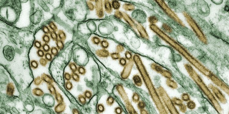Norovirus Outbreak Infects 240 Americans