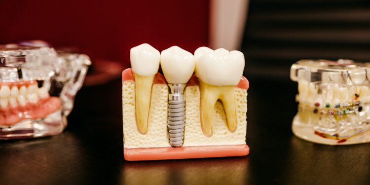 What Is The Primary Cause Of Tooth Decay?