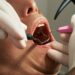 What Is The Recommended Frequency For Adults To Undergo Dental Check-Ups And Cleanings?