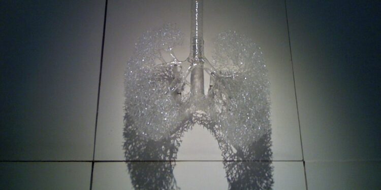 What Is The Primary Purpose Of Surfactant In The Lungs?