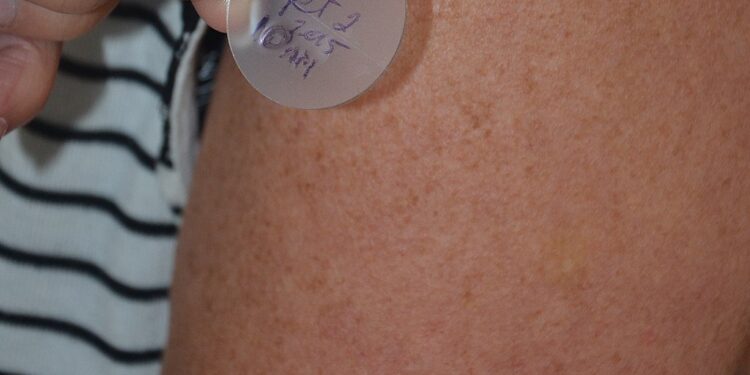 High-Tech Skin Patch To Revolutionize Blood Pressure Monitoring