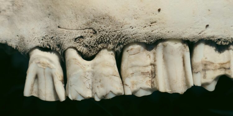 Popular Thyroid Medication May Harm Bone Strength