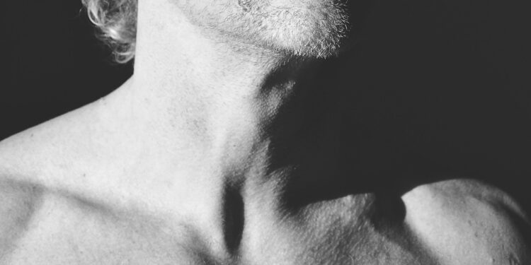 Which Is An Autoimmune Disease Affecting The Thyroid?