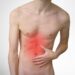 What Condition Involves Chronic Stomach Lining Inflammation?