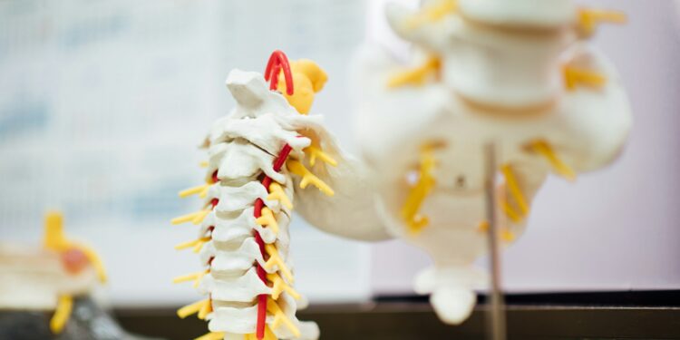 Miracle Spinal Implant Brings Hope To Muscle Disease Sufferers