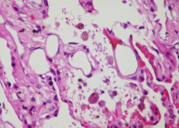 What Is The Term For Fat That Regulates Temperature And Burns Calories?