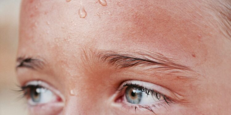 What Is The Condition Where The Body Can’t Sweat And Regulate Temperature?