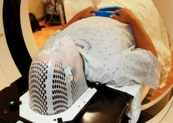 Powerful MRI Technology Transforms Epilepsy Surgery Outcomes