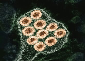 Rabies Claims Life Of Organ Transplant Patient