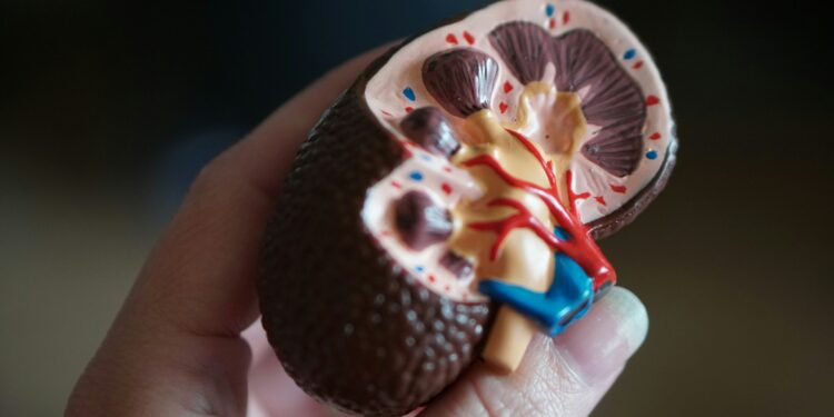 Major Medical Advancement Boosts Kidney Transplants