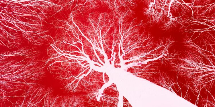 What Condition Limits Blood Flow To The Heart?