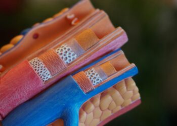 What Condition Narrows Arteries, Reducing Blood Flow To Limbs?