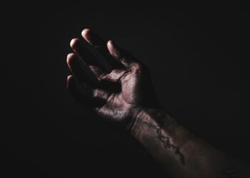 What Condition Is Caused By Prolonged Deficiency Of Thiamine?