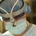 Groundbreaking Surgery Uses Eye To Access Spine