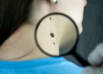 New Tech Sharpens Skin Cancer Detection