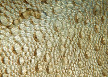 Fish Skin Used To Treat Life-Threatening Infant Wound