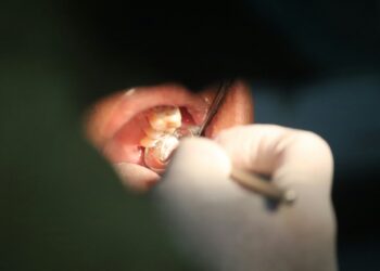 Fluoride Ban Could Cause Cavity Catastrophe