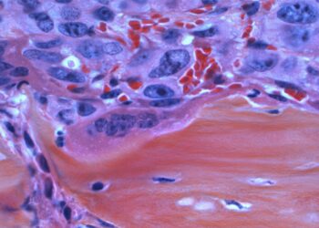 Detect Cancer Before It Strikes