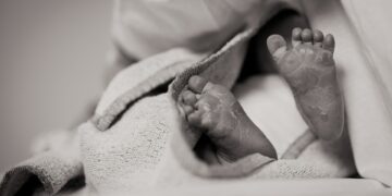 New Birth Defect Found In Newborns