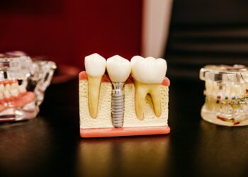 What Is The Primary Cause Of Tooth Decay?