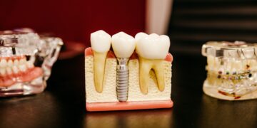 What Is The Primary Cause Of Tooth Decay?