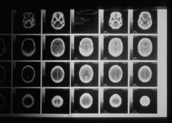 Potential Strategy To Preserve Cognitive Function