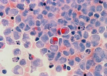 New Report Raises Awareness of Growing Cancer Cases