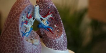 New Findings Hint At A Potential Link To Aggravated COPD