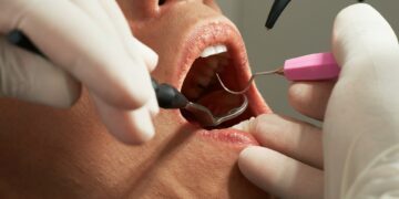 What Is The Recommended Frequency For Adults To Undergo Dental Check-Ups And Cleanings?