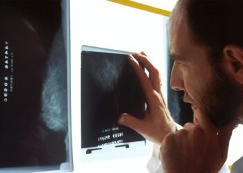 Remarkable Potential Of A Drug Linked To Cocaine Treatment