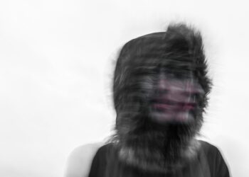 Shocking Disorder Turns Faces Into Living Nightmares