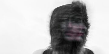 Shocking Disorder Turns Faces Into Living Nightmares