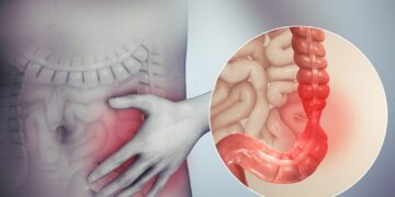 The Superior Treatment For Ending IBS