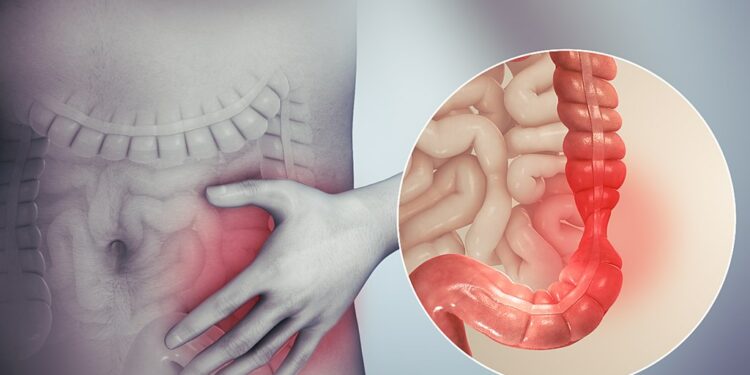 The Superior Treatment For Ending IBS