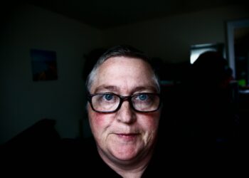 Conquer Rosacea And Reclaim Confidence