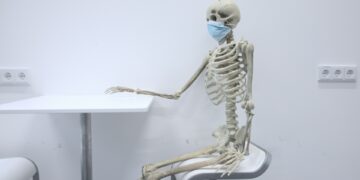 Which Of The Following Is NOT A Risk Factor For Osteoporosis?