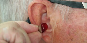 What’s The Medical Term For Ear Ringing Or Buzzing Sensation?