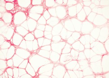 Unique Cells Linked To Surprising Weight Gain