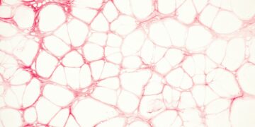 Unique Cells Linked To Surprising Weight Gain