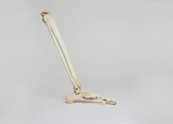 Which Type Of Exercise Is Most Effective At Increasing Bone Density?