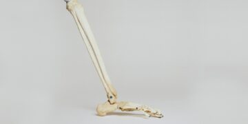 Which Type Of Exercise Is Most Effective At Increasing Bone Density?