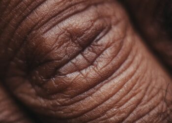 What Is The Main Protein Found In Skin And Connective Tissues?