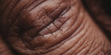 What Is The Main Protein Found In Skin And Connective Tissues?