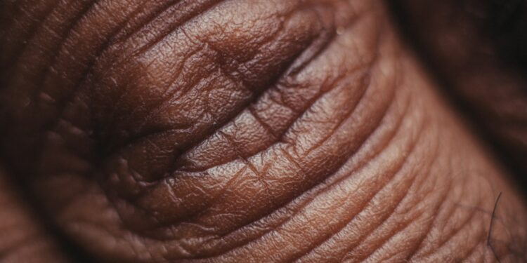 What Is The Main Protein Found In Skin And Connective Tissues?