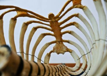 What Is The Term For A Condition Characterized By The Thinning And Weakening Of Bones?