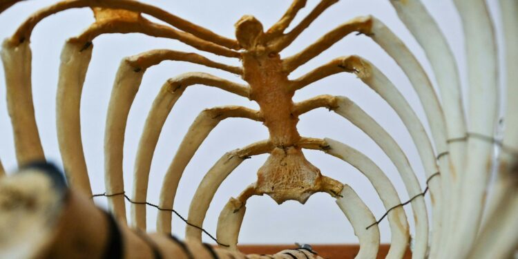 What Is The Term For A Condition Characterized By The Thinning And Weakening Of Bones?