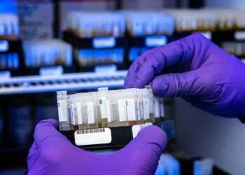 Which Type Of Cell Is Primarily Responsible For Producing Antibodies?