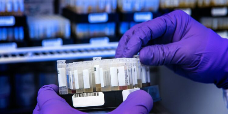 Which Type Of Cell Is Primarily Responsible For Producing Antibodies?