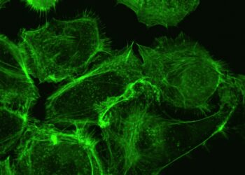 What Is The Most Common Cause of Hypothyroidism Worldwide?